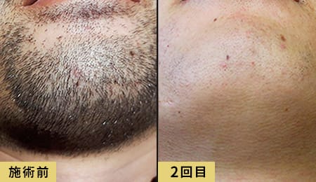 販促用症例素材