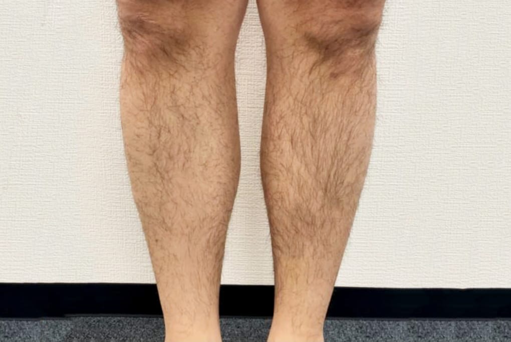 施術前